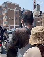 온 몸에 털로 덮여있는 사람 등장 온 몸에 털로 덮여있는 사람 등장 - 관련 글 썸네일