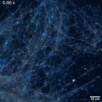 뇌에서 뉴런 네트워킹할 때 불빛이 일어나는 현상 뇌에서 뉴런 네트워킹할 때 불빛이 일어나는 현상 - 관련 글 썸네일