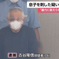 52세 아들 상습 폭력에 살인미수 체포된 아버지, 얼굴 멍 자국 '참혹' - 관련 글 썸네일