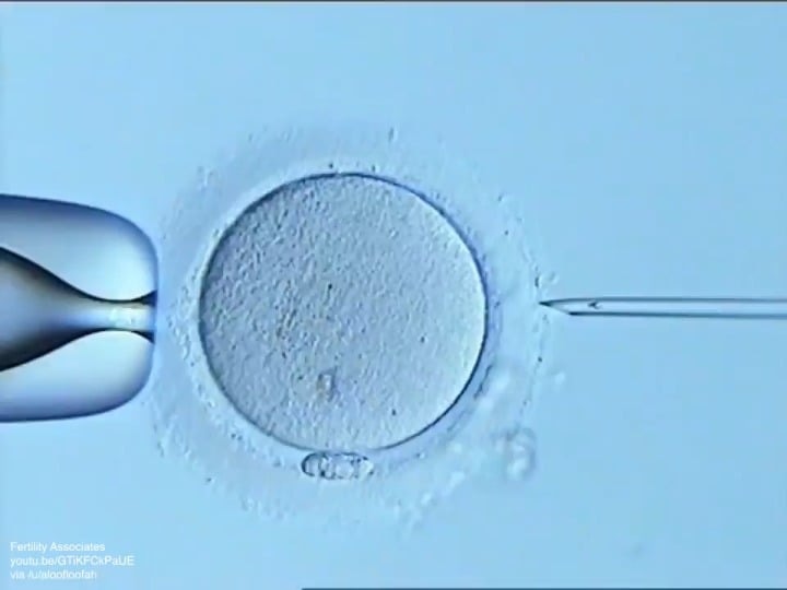 정자 하나를 난자에 직접 주사하는 방법 정자 하나를 난자에 직접 주사하는 방법 - 관련 글 썸네일